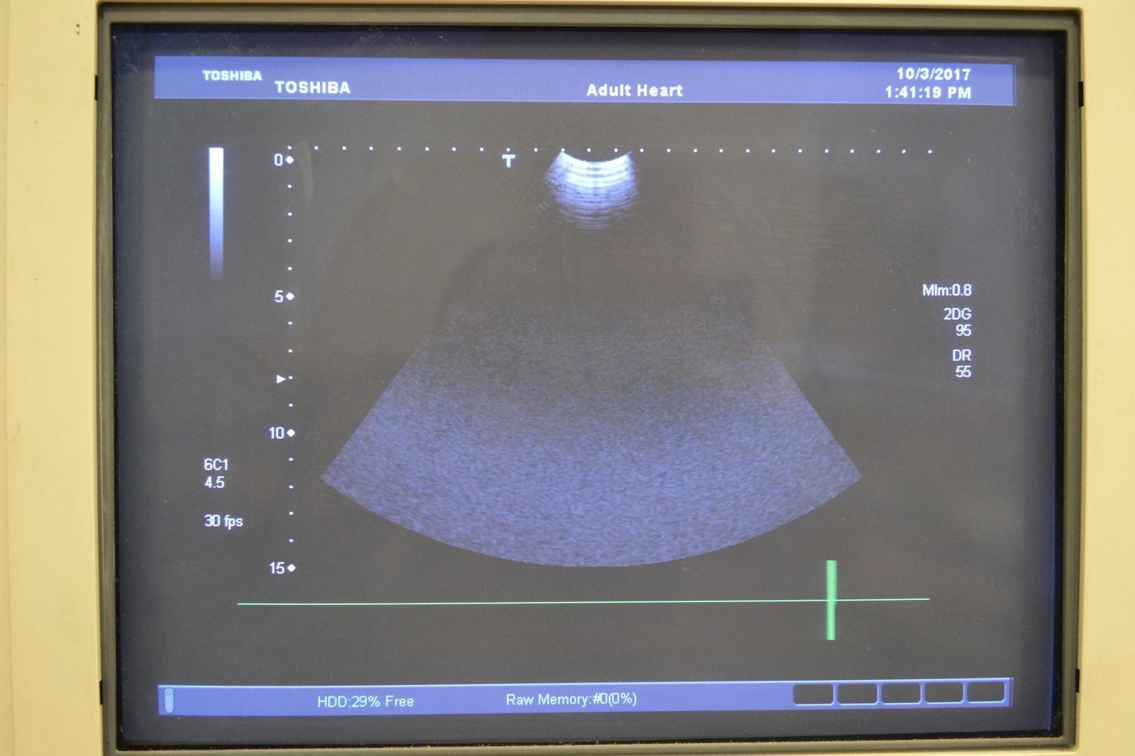 Toshiba Viamo PVT-382BT 5.5-1.8MHz Convex Ultrasound Transducer Probe J1635 DIAGNOSTIC ULTRASOUND MACHINES FOR SALE