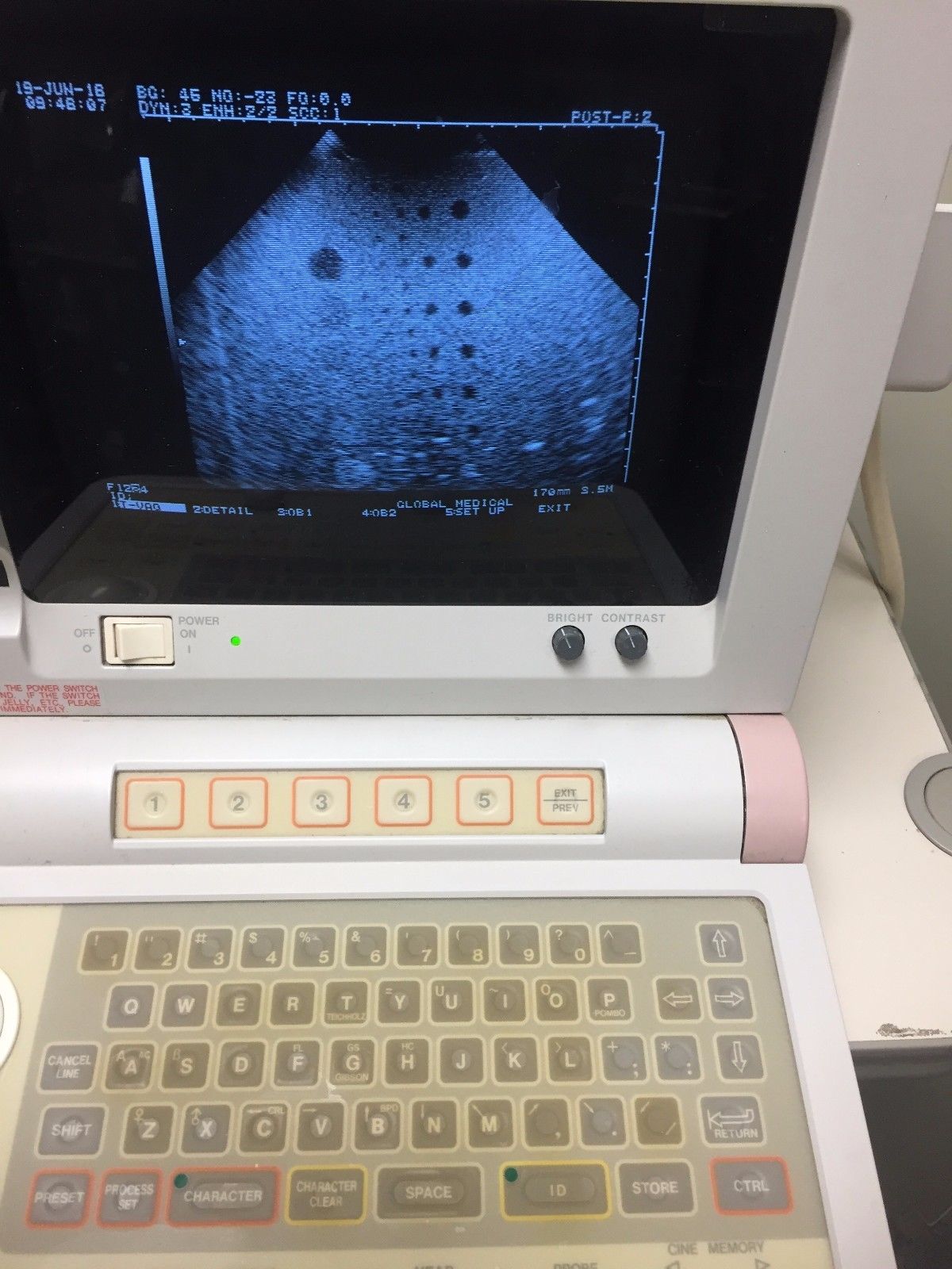 Hitachi EUB-405 Plus Ultrasound / 2 probes / 2 transducer port / printer DIAGNOSTIC ULTRASOUND MACHINES FOR SALE