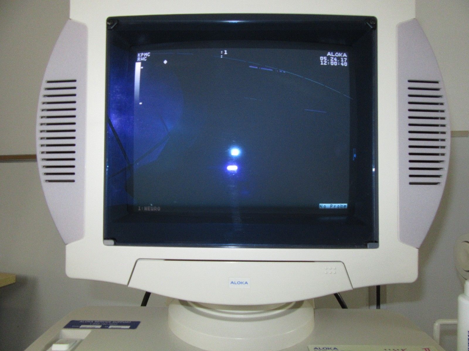 Aloka UltraSound SSD-1700 dynaview USI -140B Holiday Special!!! DIAGNOSTIC ULTRASOUND MACHINES FOR SALE