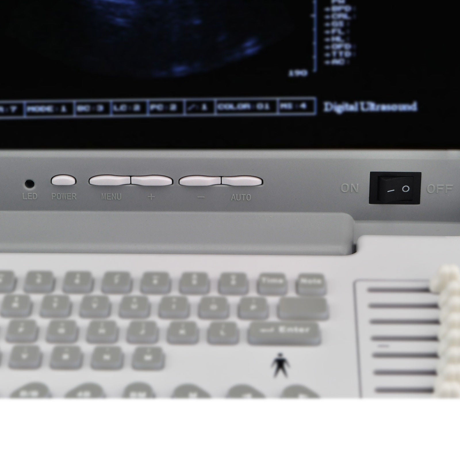 12-Inch Portable Digital Ultrasound Scanner Machine Convex Transvaginal 2 Probes DIAGNOSTIC ULTRASOUND MACHINES FOR SALE