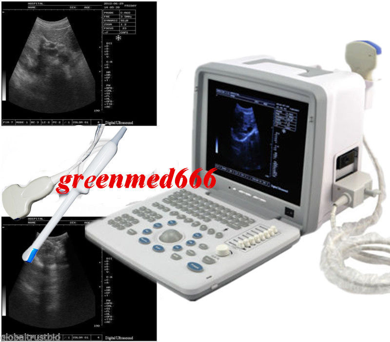 SW Digital Portable Ultrasound Scanner + Convex + Transvaginal 2 Probe 3D Image 190891690616 DIAGNOSTIC ULTRASOUND MACHINES FOR SALE