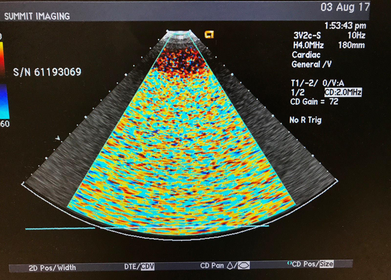 2008 Acuson 3V2c Ultrasound Transducer Probe 08260628 DIAGNOSTIC ULTRASOUND MACHINES FOR SALE