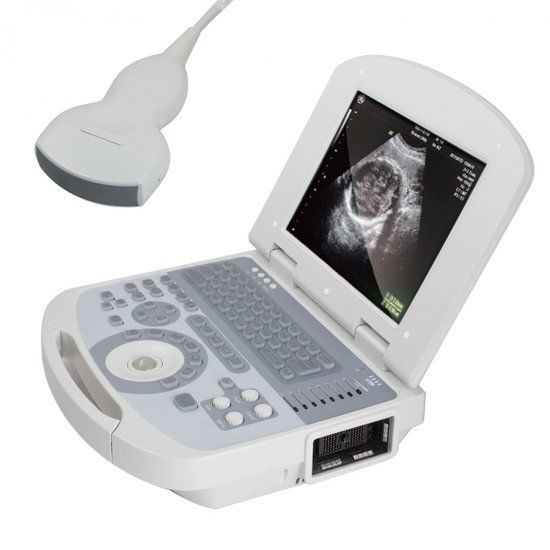 USA Fast 96 Element Clear Digital Laptop Ultrasound Scanner System +Convex probe 190891205612 DIAGNOSTIC ULTRASOUND MACHINES FOR SALE