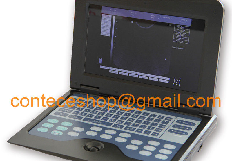 Portable laptop machine digital ultrasound scanner+probe for human,USA Warehouse DIAGNOSTIC ULTRASOUND MACHINES FOR SALE