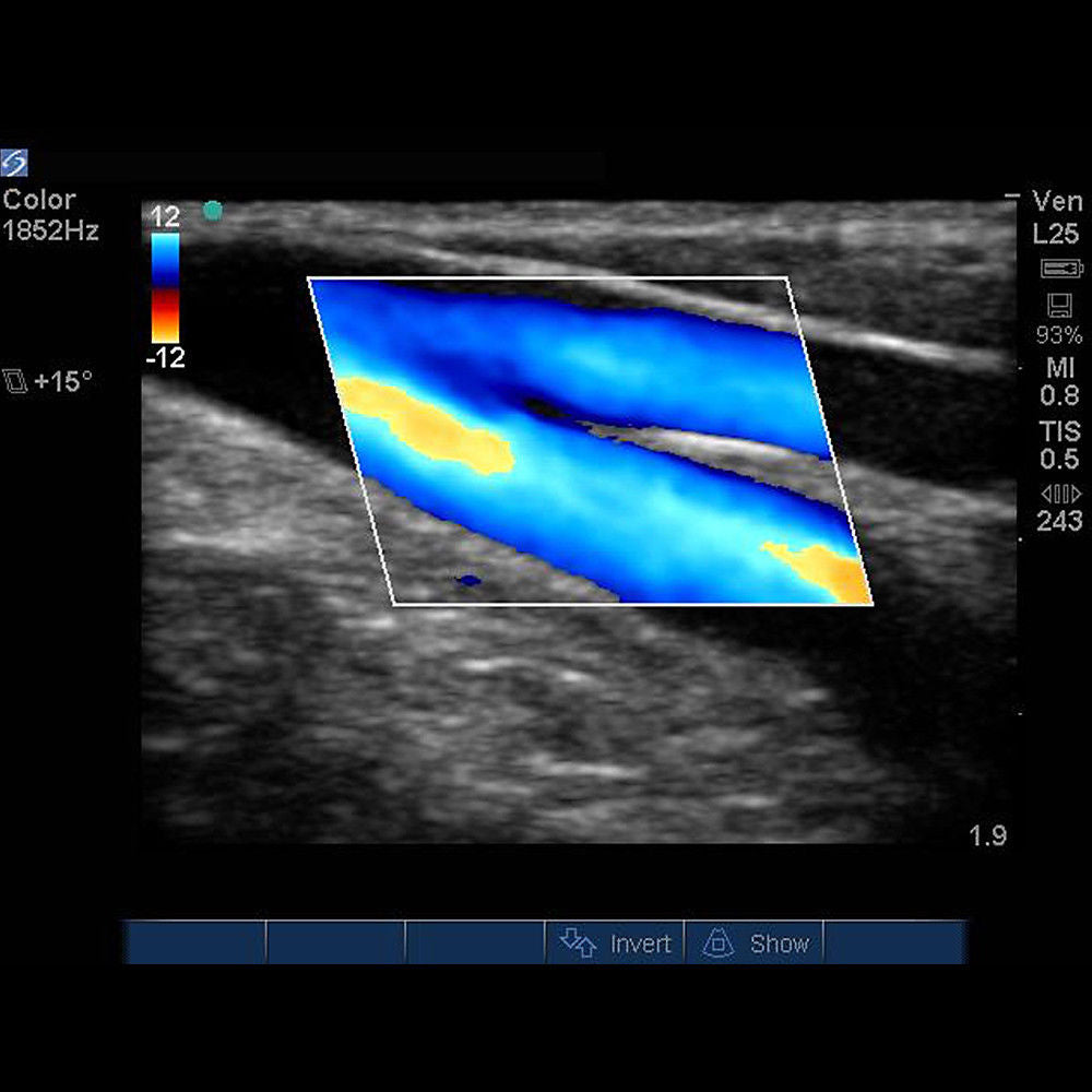 FUJIFILM Ultrasound Machine SonoSite M-Turbo - Portable System Shared Service DIAGNOSTIC ULTRASOUND MACHINES FOR SALE