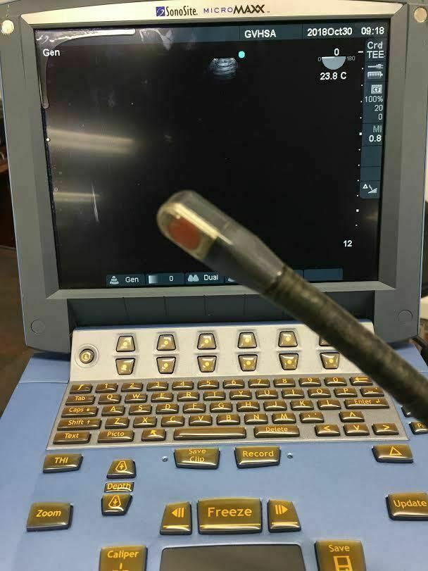 Sonosite TEE 8-3 MHz. Ultrasound Probe Transducer for MicroMaxx Ultrasound Machi DIAGNOSTIC ULTRASOUND MACHINES FOR SALE