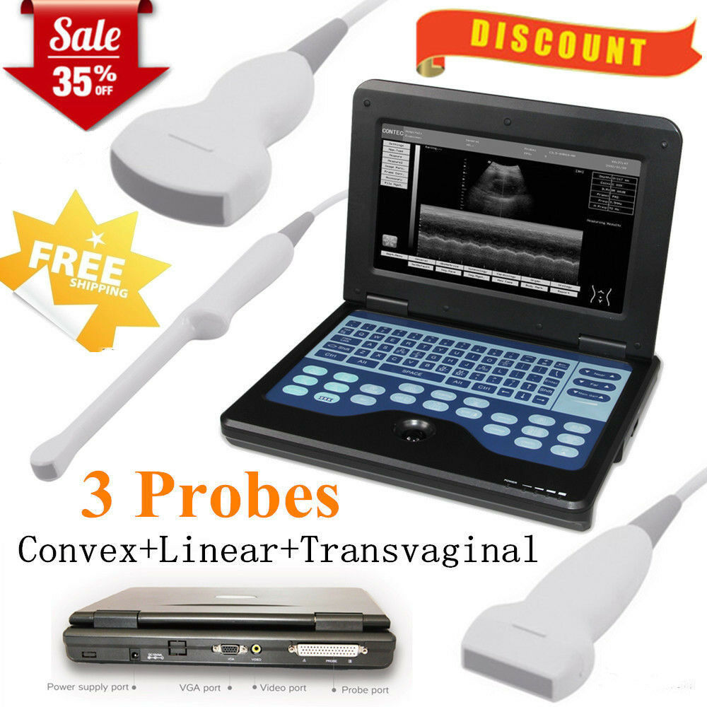 Basic Laptop Medical Ultrasound Scanner + 3 Probes Linear/ Convex/ Transvaginal DIAGNOSTIC ULTRASOUND MACHINES FOR SALE