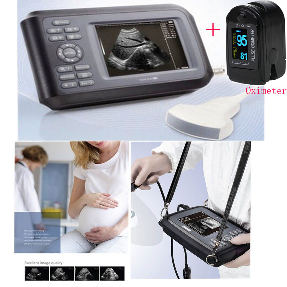 US Laptop Digital Ultrasound Scanner Convex Probe Built-in memory-64 images+SPO2 190891207166 DIAGNOSTIC ULTRASOUND MACHINES FOR SALE