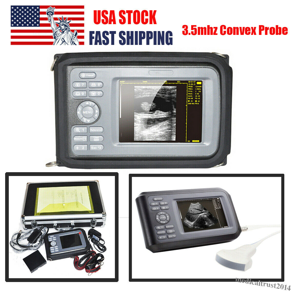 Portable Digital Handheld Human Ultrasound Scanner Machine 3.5mhz Convex Probe DIAGNOSTIC ULTRASOUND MACHINES FOR SALE