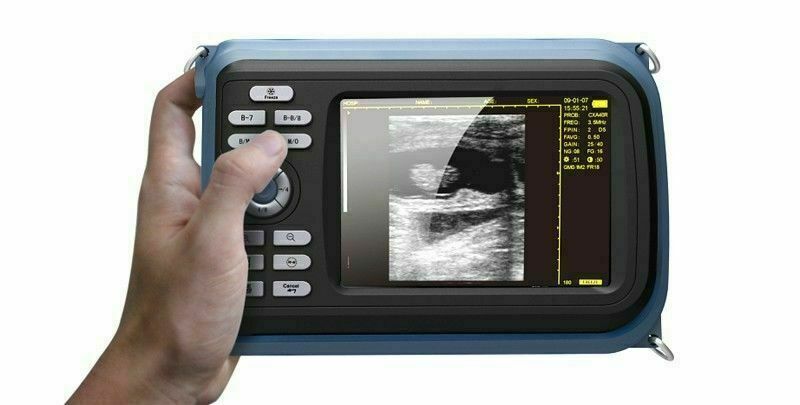 Handheld Ultrasound Scanner/Machine Convex Probe Abdominal Ultrasound Human Use DIAGNOSTIC ULTRASOUND MACHINES FOR SALE