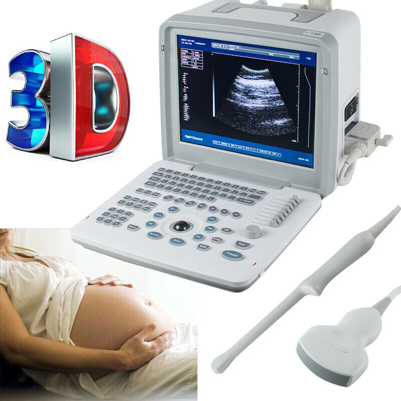 Portable Digital Ultrasound Scanner System Machine Convex +Transvaginal Probe+3D DIAGNOSTIC ULTRASOUND MACHINES FOR SALE