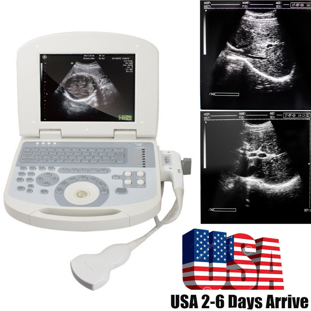 US Clear Portable Digital Laptop Medical Ultrasound Scanner Convex Probe 3D Gift 190891422491 DIAGNOSTIC ULTRASOUND MACHINES FOR SALE