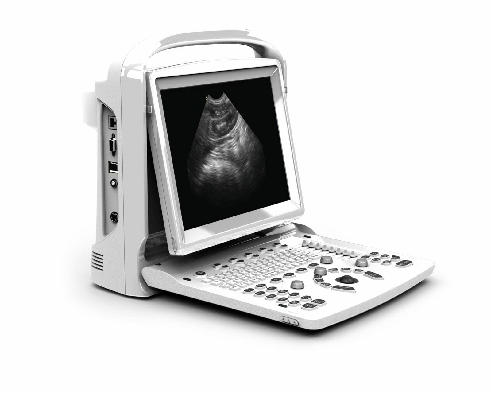 Ultrasound Chison ECO3, Amazing Quality wit Linear Array Probe, Includes Trolley DIAGNOSTIC ULTRASOUND MACHINES FOR SALE