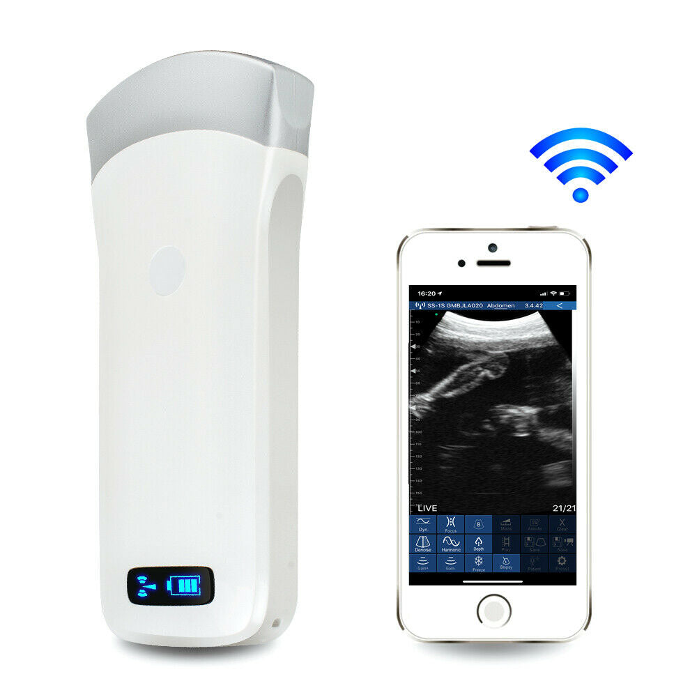 Wireless 3.5Mhz WIFI Ultrasound Scanner Electronic Array Probe IOS Android USB DIAGNOSTIC ULTRASOUND MACHINES FOR SALE