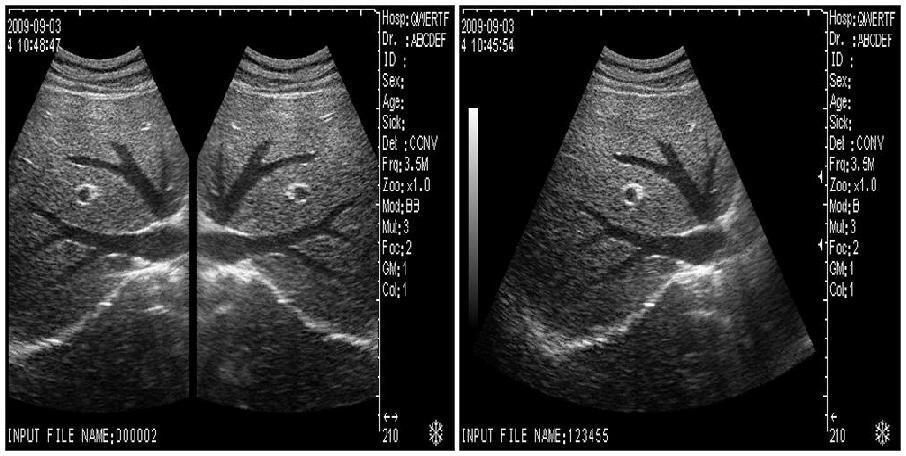 CE New Ultrasound Scanner Machine B scan + Micro-convex Probe +3D High Quality DIAGNOSTIC ULTRASOUND MACHINES FOR SALE