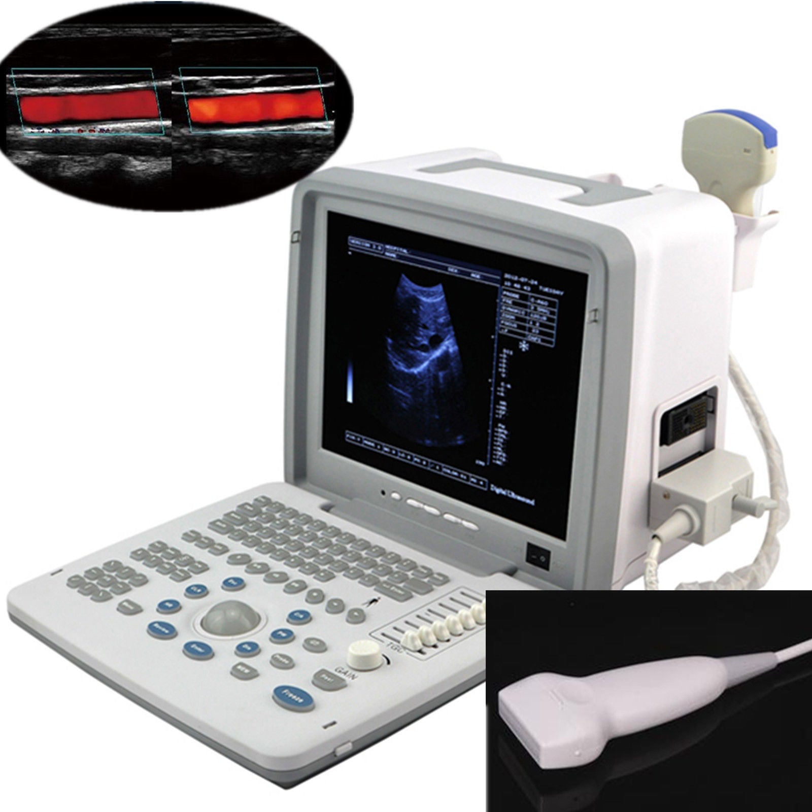 Safe 12'' Digital Ultrasound Ultrasonic Scanner Convex Linear Probes+3D Software 190891976321 DIAGNOSTIC ULTRASOUND MACHINES FOR SALE