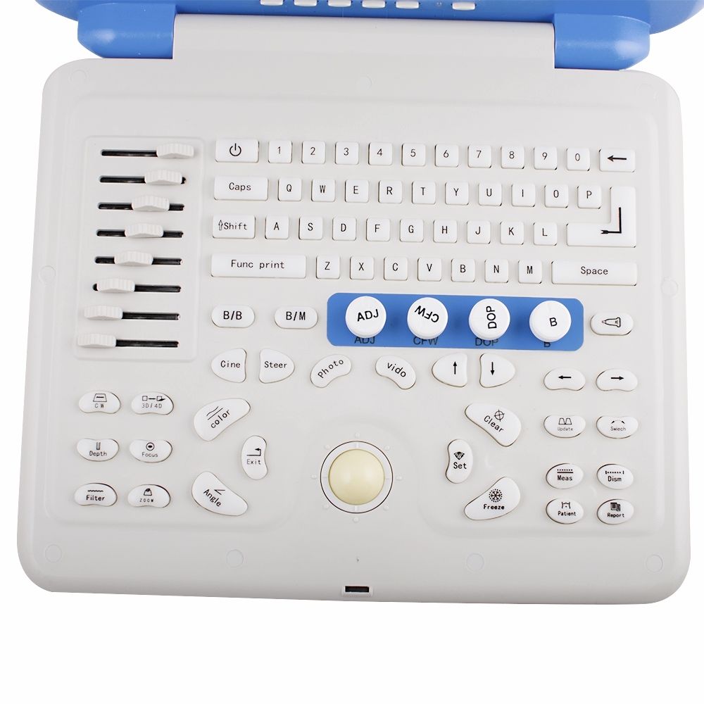 Portable B ultrasonic Color Doppler Ultrasound Scanner Convex +Linear 2 Probe A+ 190891271396 DIAGNOSTIC ULTRASOUND MACHINES FOR SALE
