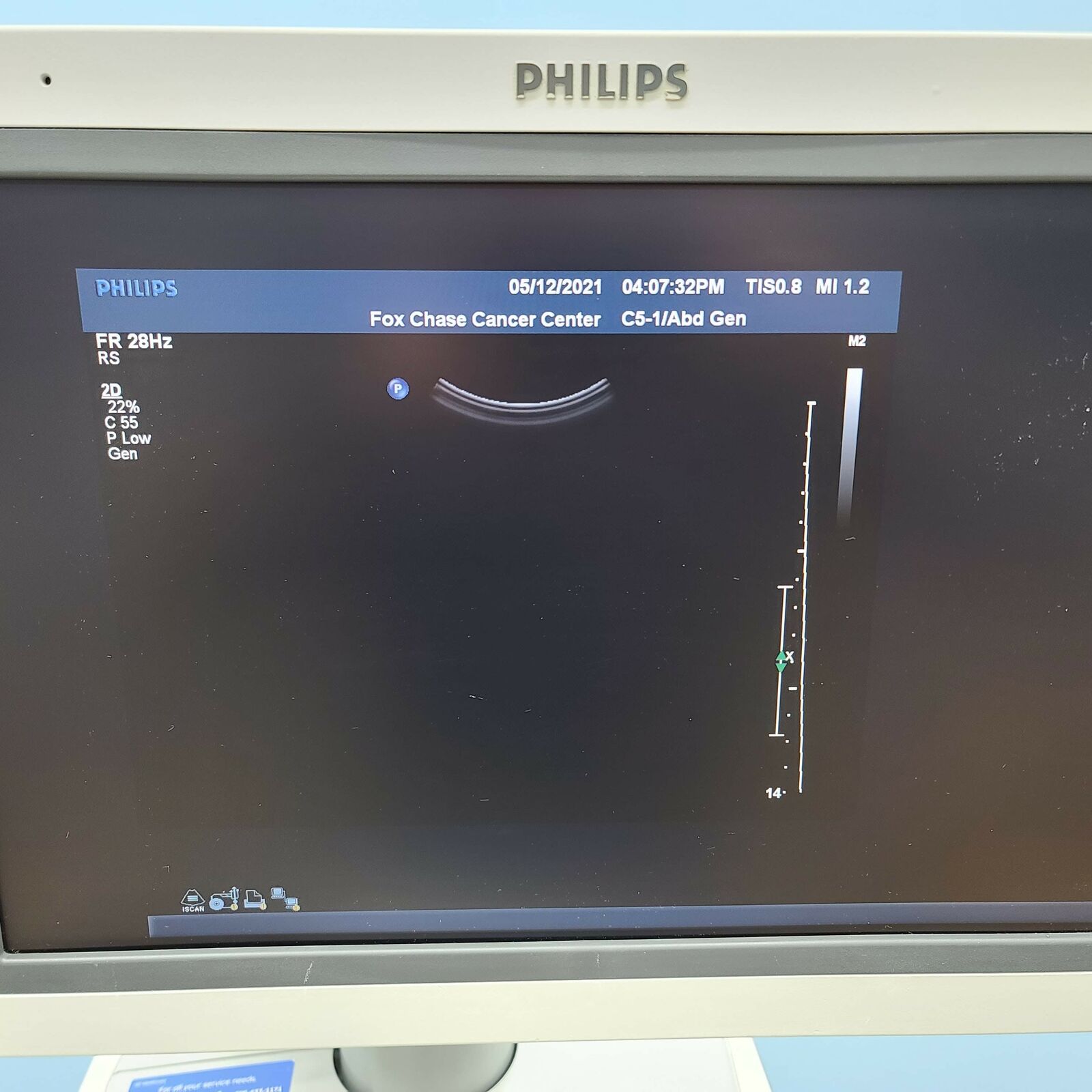 PHILIPS iU22 Diagnostic Ultrasound System with 2 Probes DIAGNOSTIC ULTRASOUND MACHINES FOR SALE