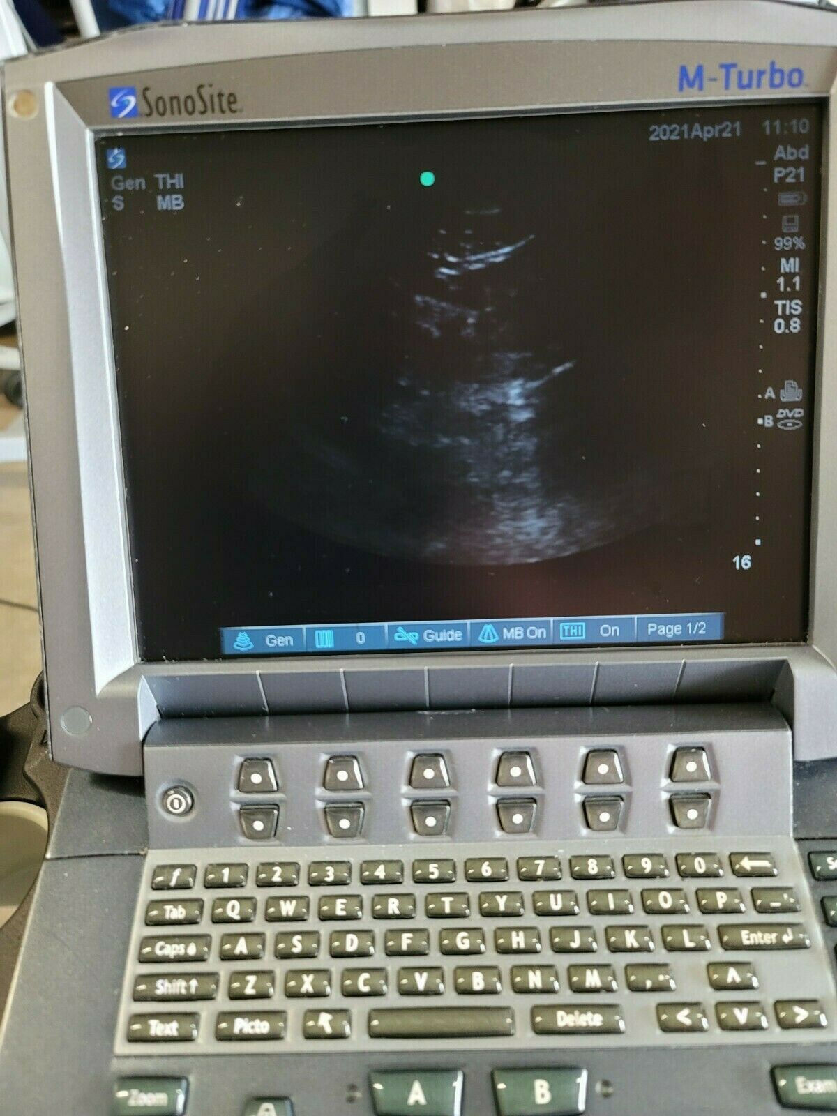 Sonosite M-Turbo Ultrasound System with Probe P21x (5-1MHz)  DIAGNOSTIC ULTRASOUND MACHINES FOR SALE