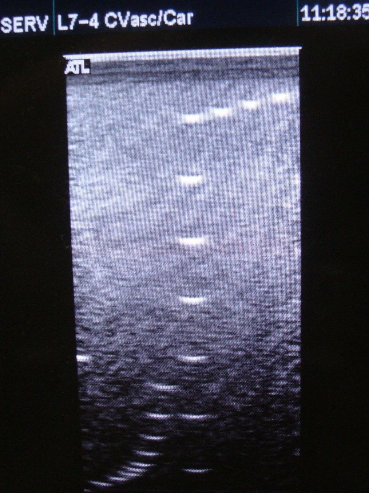 L7-4 LINEAR ARRAY TRANSDUCER PROBE FOR ATL HDI 5000 SONOCT ULTRASOUND SYSTEM DIAGNOSTIC ULTRASOUND MACHINES FOR SALE