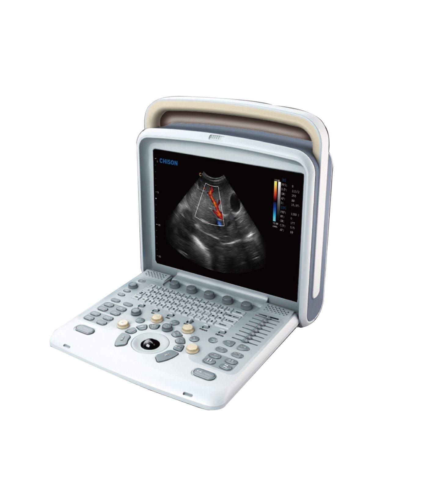 Veterinary Ultrasound Scanner with Two probes - Color Doppler Chison Q5Vet DIAGNOSTIC ULTRASOUND MACHINES FOR SALE