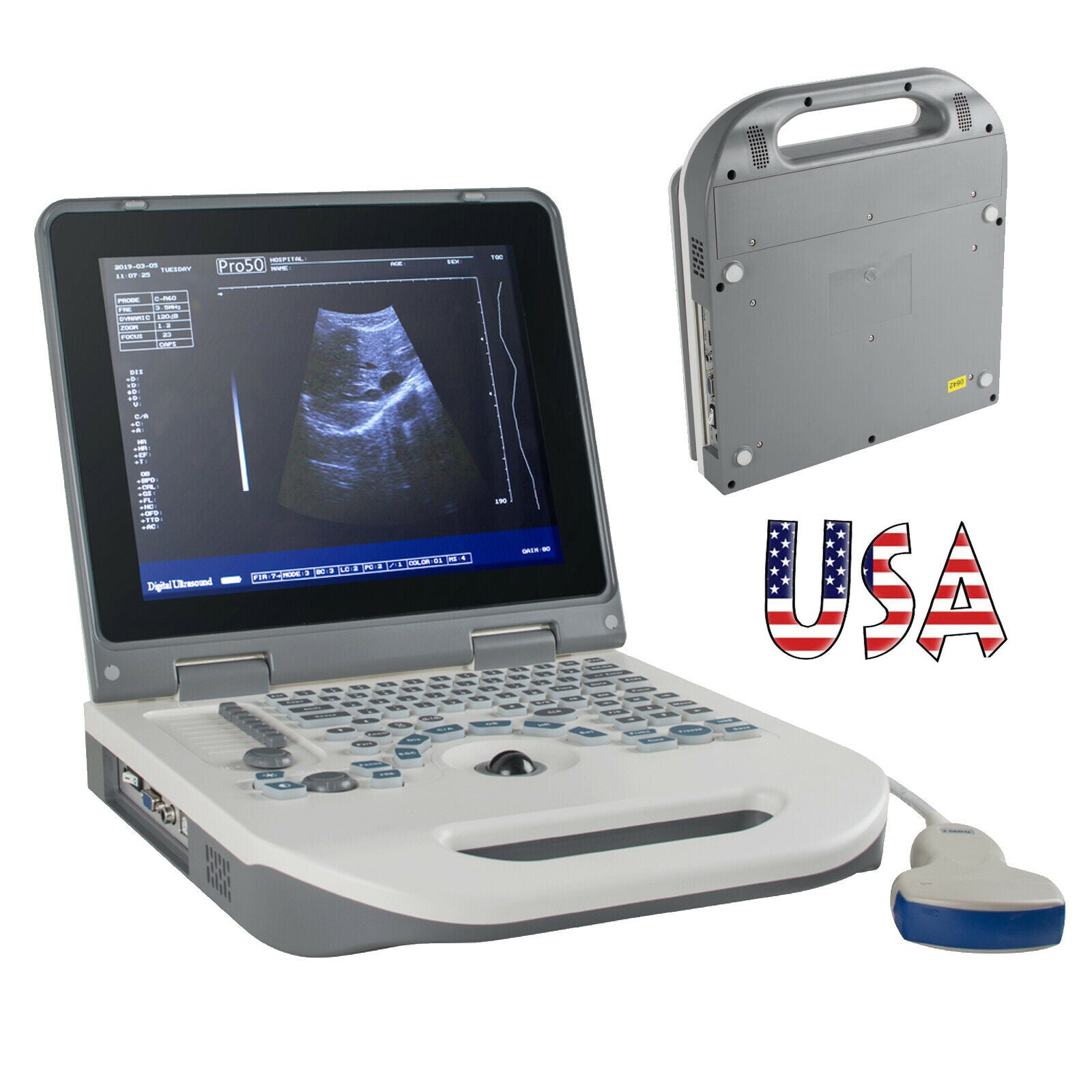 USA Full Digital Ultrasound Scanner Ultrasonic MachineDisgnos Convex Probe 3D CE DIAGNOSTIC ULTRASOUND MACHINES FOR SALE