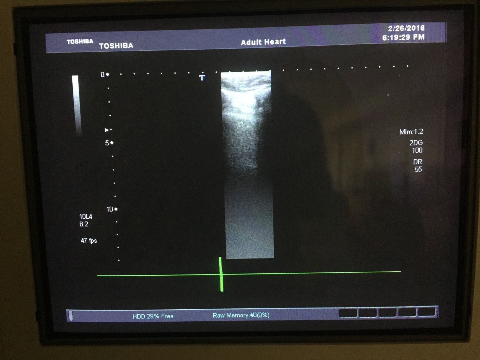 Toshiba Aplio 500 PLT-604AT 6MHz Linear Ultrasound Transducer DIAGNOSTIC ULTRASOUND MACHINES FOR SALE