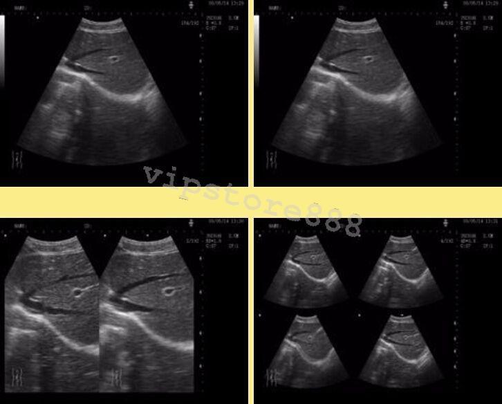 Digital Ultrasound Scanner Machine  +Convex +Vaginal + Linear 3 Probes/Sensor+3D DIAGNOSTIC ULTRASOUND MACHINES FOR SALE