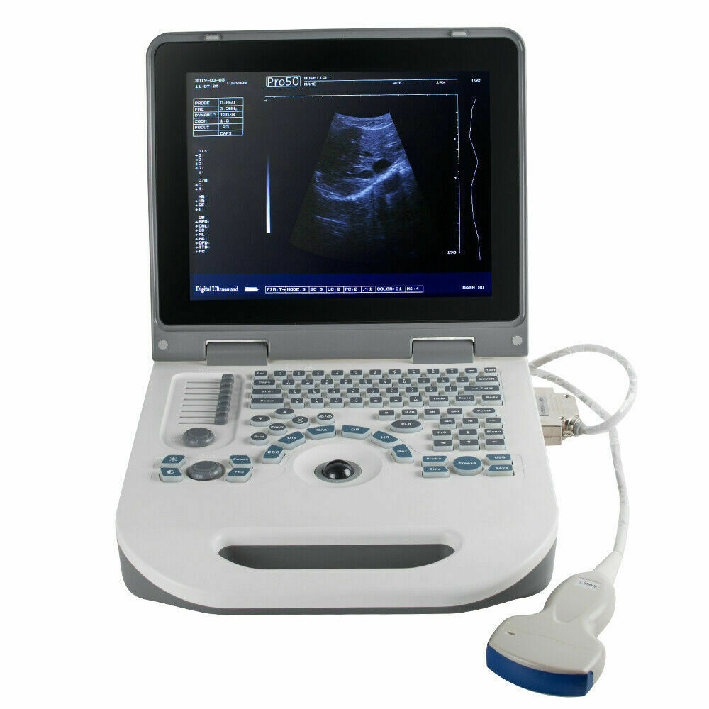 USA Full Digital Ultrasound Scanner Ultrasonic MachineDisgnos Convex Probe 3D CE DIAGNOSTIC ULTRASOUND MACHINES FOR SALE