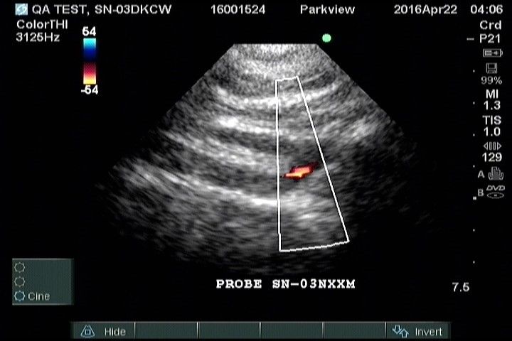 Sonosite M-Turbo Portable Ultrasound System DIAGNOSTIC ULTRASOUND MACHINES FOR SALE