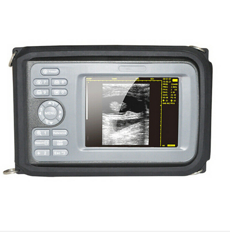 5.5'' Portable Digital Handheld Ultrasound Scanner Laptop Machine+Convex Probe DIAGNOSTIC ULTRASOUND MACHINES FOR SALE