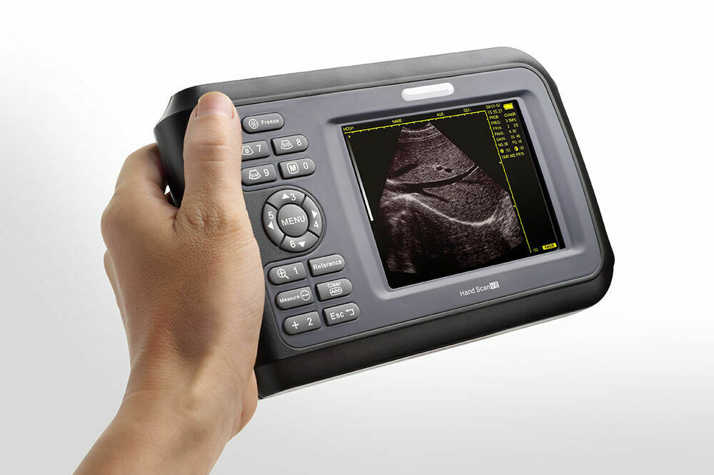 5.5" Handheld Digital Ultrasound Scanner LCD HandScan 3.5MHz Convex Probe  Case DIAGNOSTIC ULTRASOUND MACHINES FOR SALE