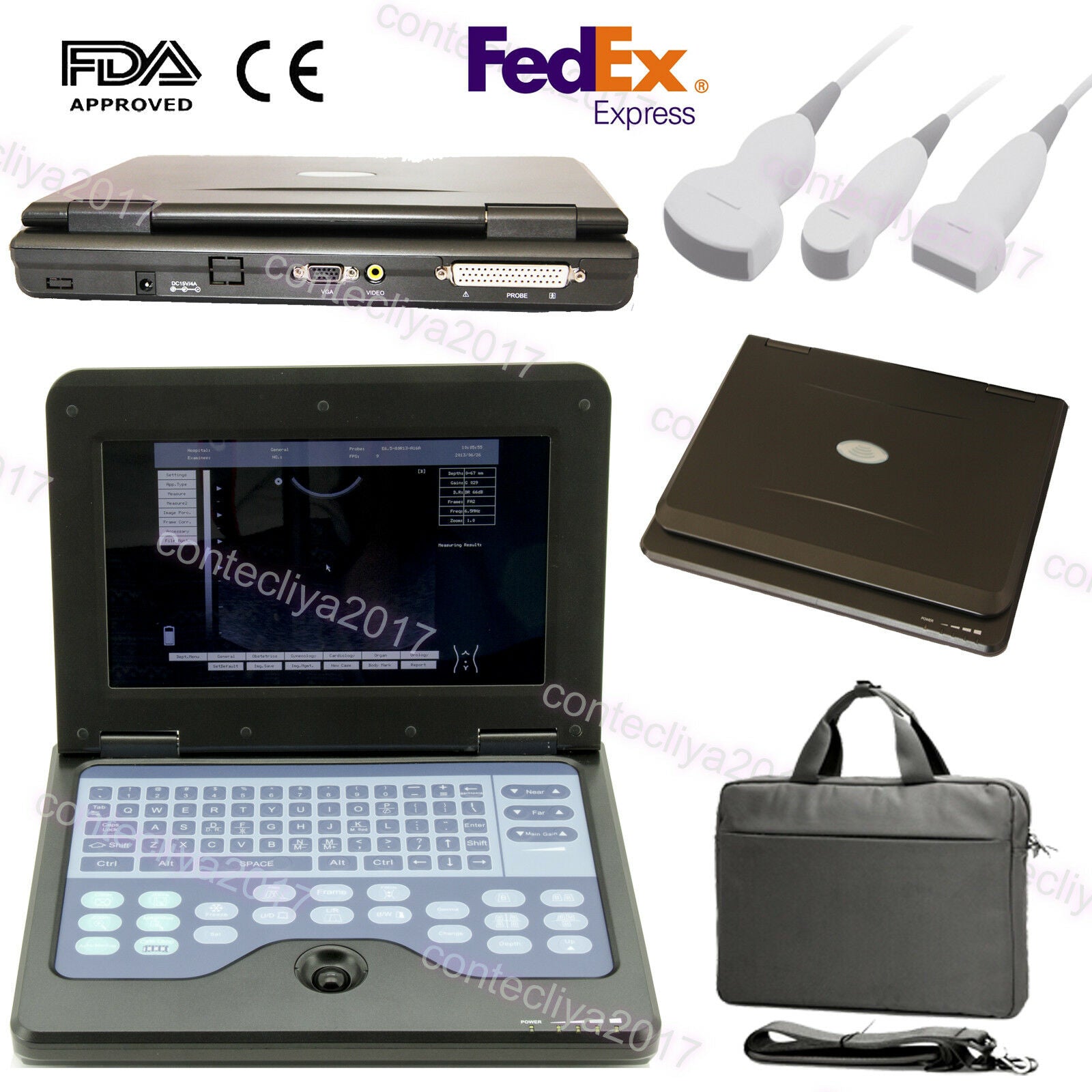 USA,Portable Ultrasound Scanner Laptop Machine Convex/Linear/Cardiac/Tranvaginal DIAGNOSTIC ULTRASOUND MACHINES FOR SALE