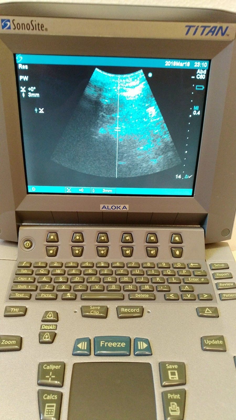 Sonosite Titan portable ultrasound system MODULE ONLY DIAGNOSTIC ULTRASOUND MACHINES FOR SALE