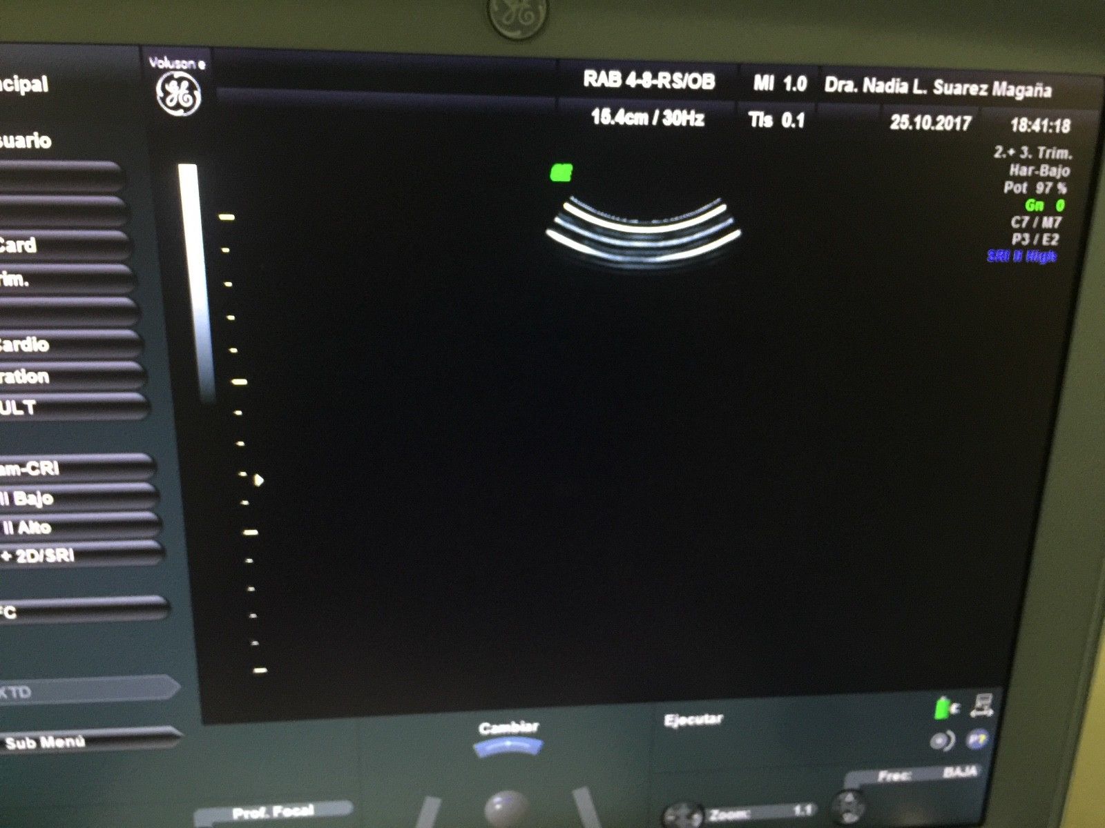 GE RAB4-8-RS 4D CONVEX PROBE FOR VOLUSON i/e/S6/S8 DIAGNOSTIC ULTRASOUND MACHINES FOR SALE