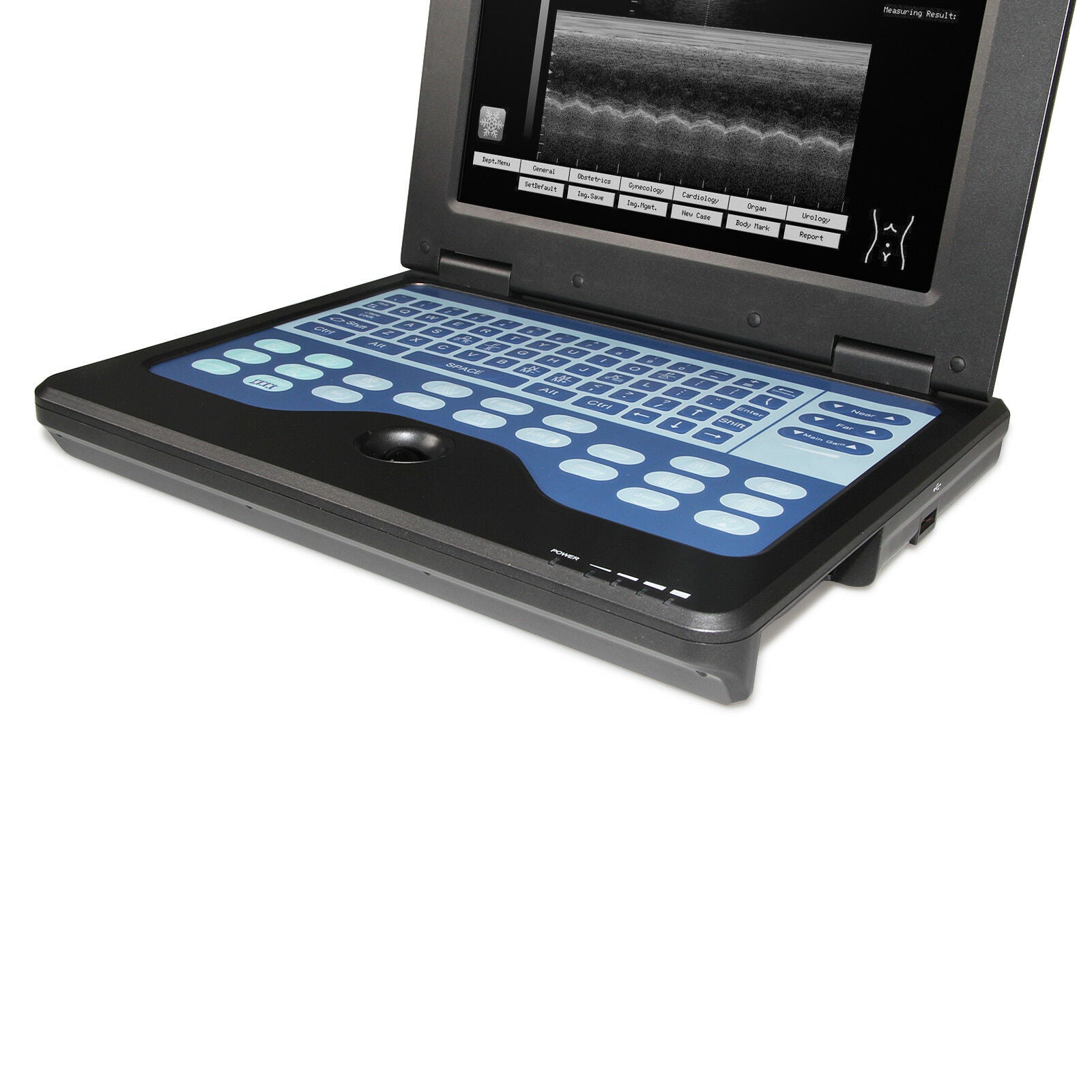 USA Seller,Digital Ultrasound Scanner Portable Laptop Ultrasound Machine+Convex DIAGNOSTIC ULTRASOUND MACHINES FOR SALE