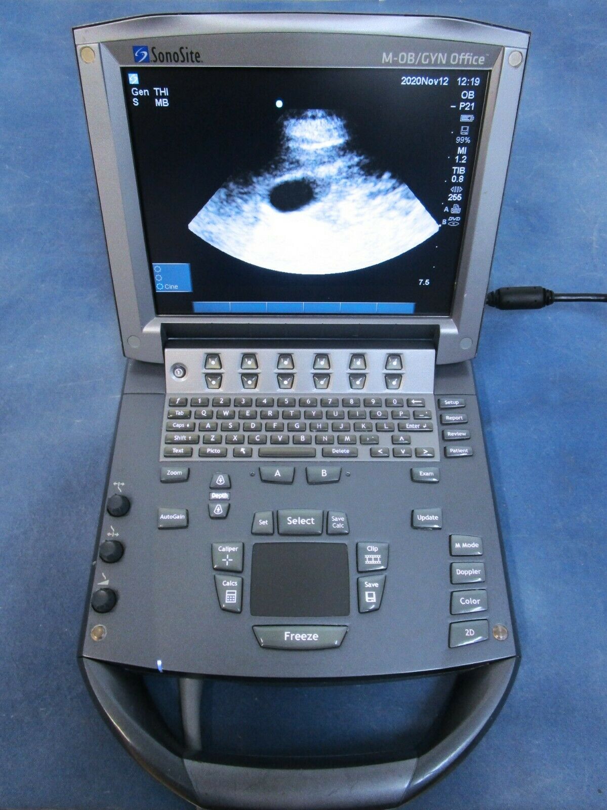 Sonosite M-Turbo Ultrasound System Complete - 60 Day Warranty DIAGNOSTIC ULTRASOUND MACHINES FOR SALE