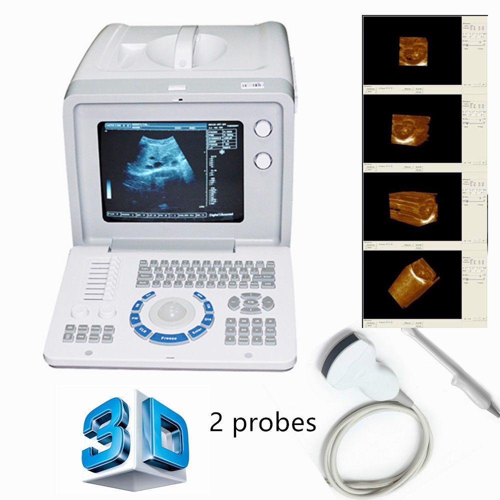 Top Digital Portable Ultrasound Scanner Device + Convex +Transvaginal Probes+ 3D DIAGNOSTIC ULTRASOUND MACHINES FOR SALE