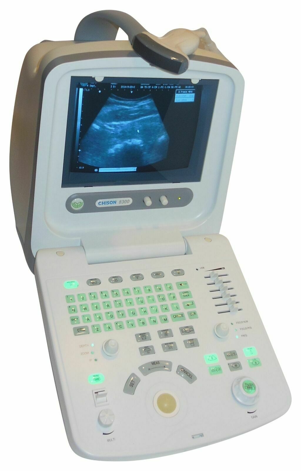 Best Deal Veterinary Ultrasound, Chison 8300Vet, Good Quality, Most Affordable DIAGNOSTIC ULTRASOUND MACHINES FOR SALE