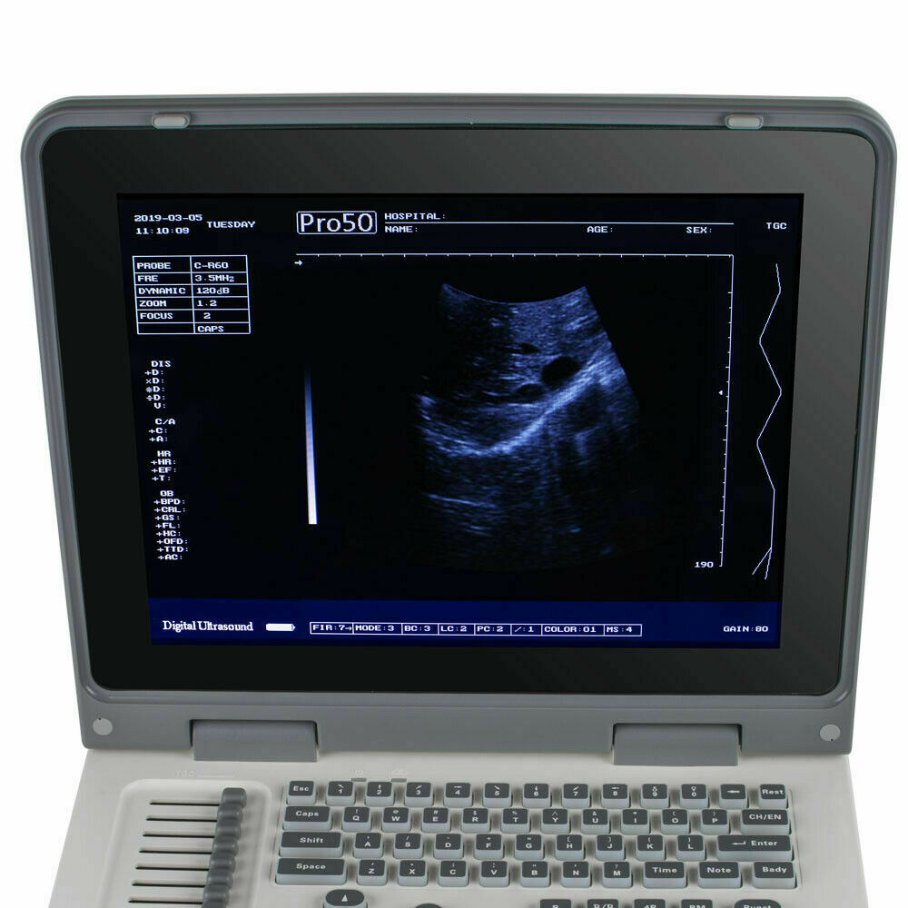 Portable Digital Ultrasound Scanner Ultrasonic MachineDisgnos Convex Probe 3D CE DIAGNOSTIC ULTRASOUND MACHINES FOR SALE