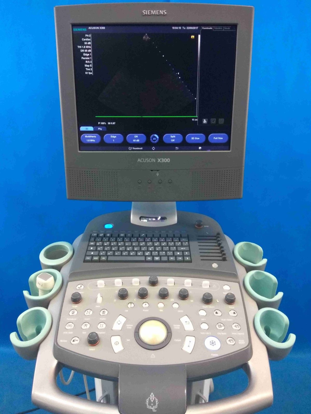 Siemens Acuson X300 Ultrasound scanner (YOM 2010) with P4-2 cardio transducer DIAGNOSTIC ULTRASOUND MACHINES FOR SALE