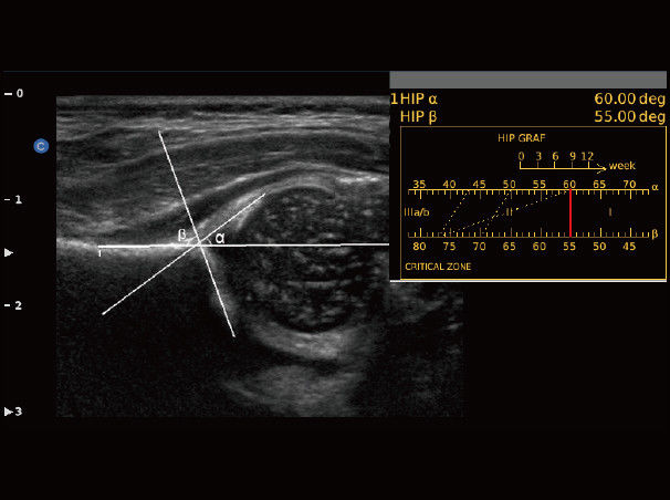 Chison eBit50 Ultrasound Color Doppler Portable Advanced 15" LED Battery 1 Probe DIAGNOSTIC ULTRASOUND MACHINES FOR SALE