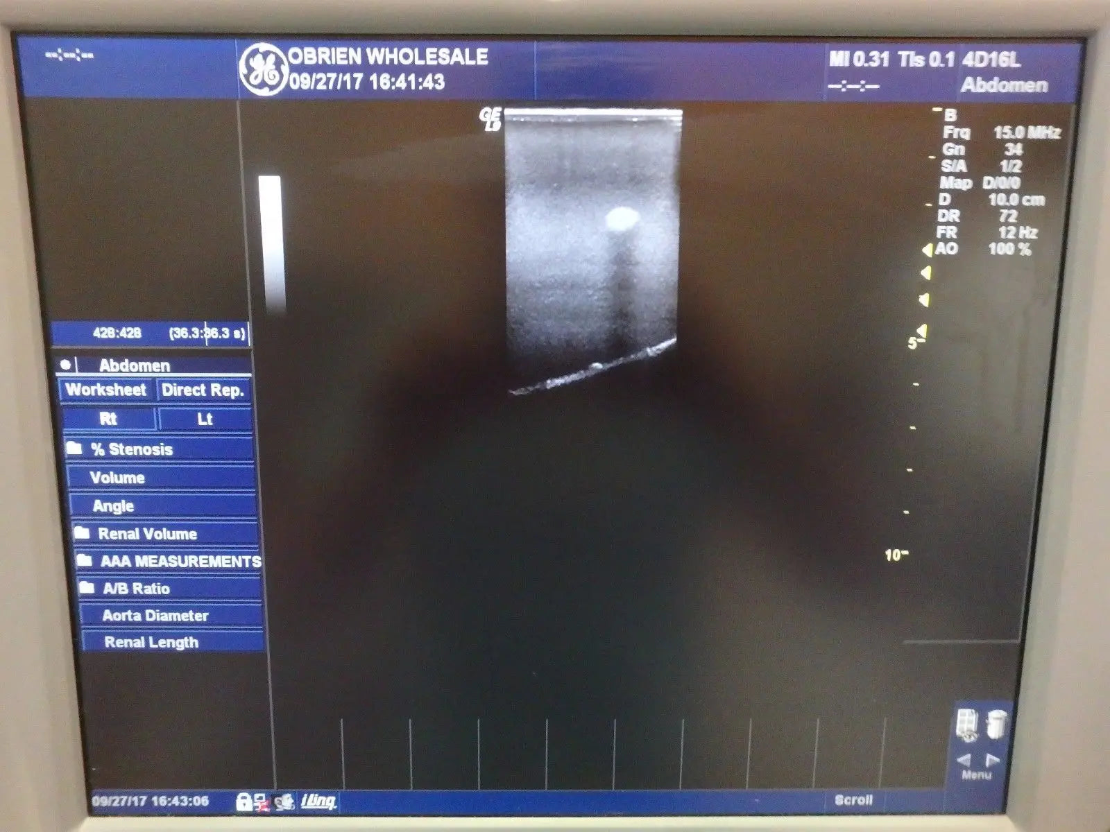 GE 4D16L 4D Linear Wide Band Ultrasound Transducer Probe 156972 DIAGNOSTIC ULTRASOUND MACHINES FOR SALE