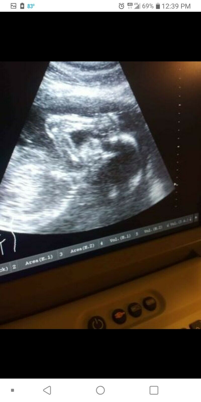 Portable Ultrasound Machine DIAGNOSTIC ULTRASOUND MACHINES FOR SALE