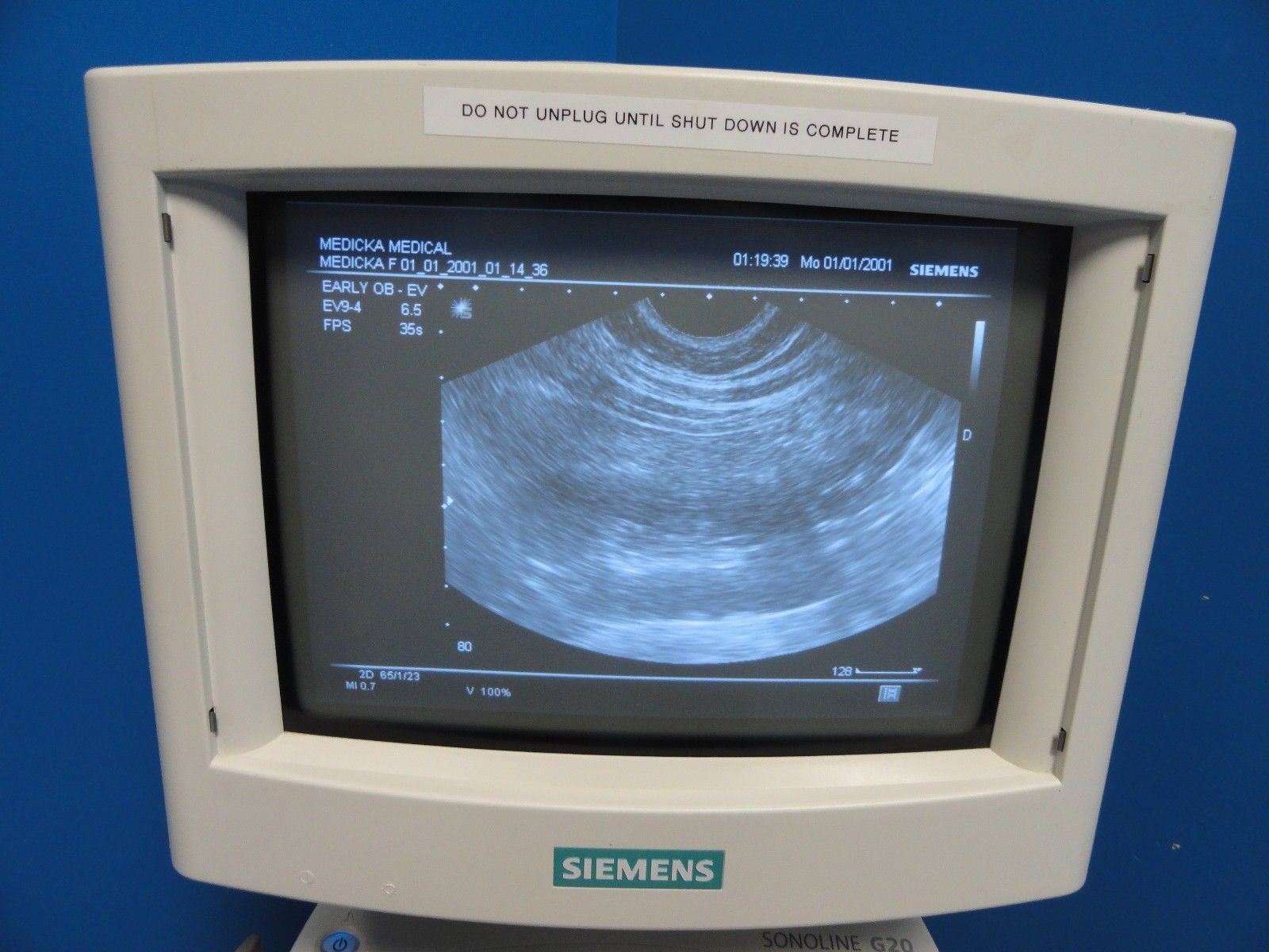 2004 Siemens Sonoline G20 Ultrasound W/ C5-2 & EV9-4 Probes Printer & UPS(10964) DIAGNOSTIC ULTRASOUND MACHINES FOR SALE