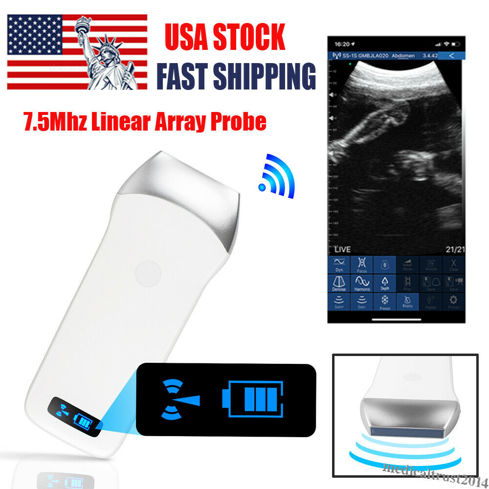 Portable Handheld WIFI Wireless Ultrasound Scanner Machine Linear Probe 7.5Mhz DIAGNOSTIC ULTRASOUND MACHINES FOR SALE