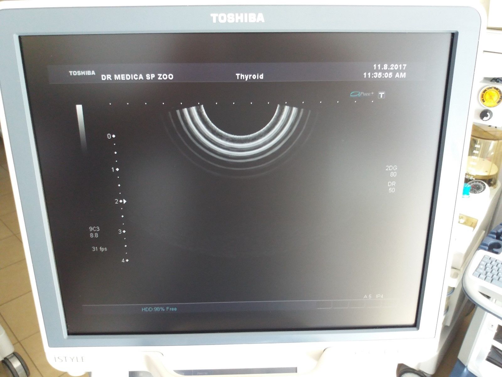 Ultrasound system Toshiba Aplio XG SSA-790A DOM 2008 230V AC power DIAGNOSTIC ULTRASOUND MACHINES FOR SALE