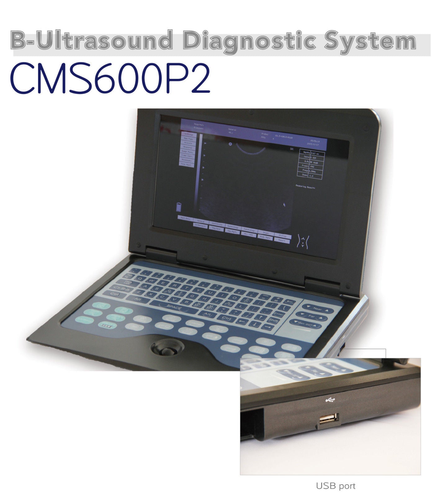 CE Portable Ultrasound Scanner Machine Laptop Diagnostic System(4 Probes Option) DIAGNOSTIC ULTRASOUND MACHINES FOR SALE