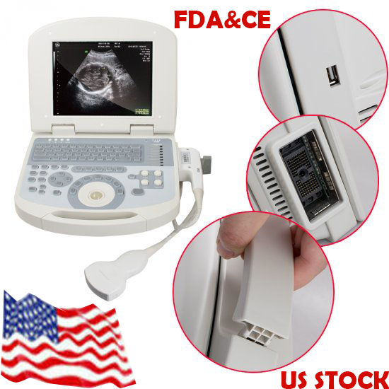 USA Portable Full Digital Laptop Medical Ultrasound Scanner+3.5mhz Convex probe DIAGNOSTIC ULTRASOUND MACHINES FOR SALE