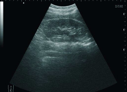 Laptop Ultrasound scanner with Transvaginal probe 3D B ultrasonic Machine Sale 190891734143 DIAGNOSTIC ULTRASOUND MACHINES FOR SALE